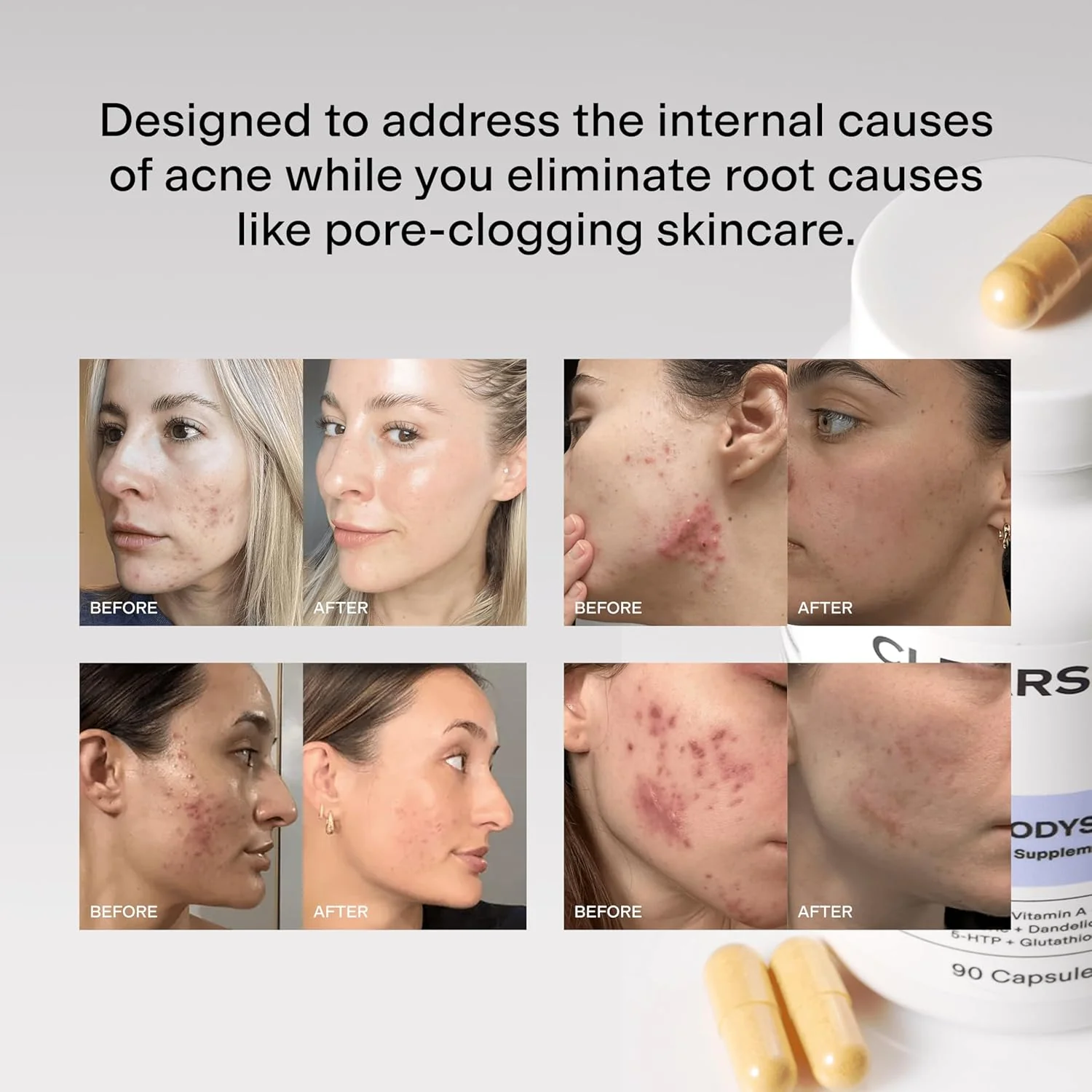 Hormoneplus® Hormonal Acne Supplement - Image 3